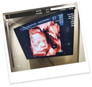 imagem ultrassom bebe