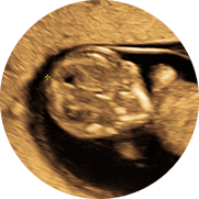 imagem de obstetrico transvaginal